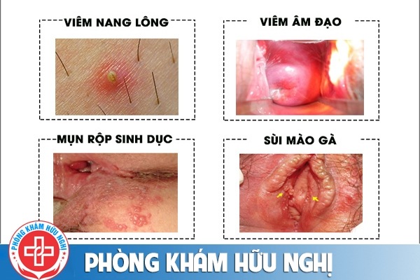 am-dao-noi-mun