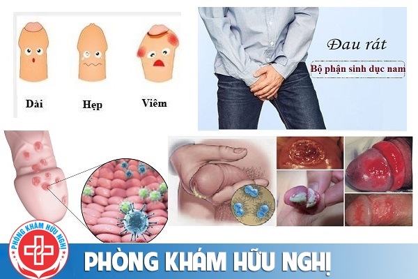 benh-duong-vat