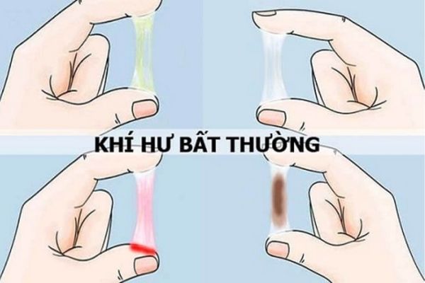 benh-huyet-trang-nguy-hiem-nhu-the-nao-02