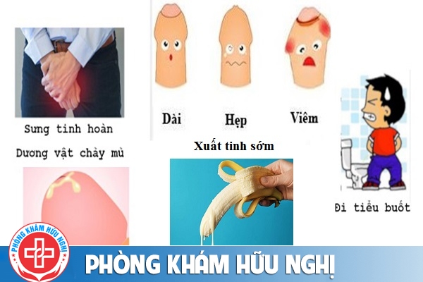 benh-nam-khoa-hay-gap-la-gi