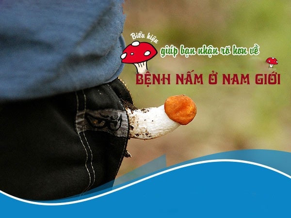 Bệnh nấm ở nam giới và cách hỗ trợ điều trị kịp thời