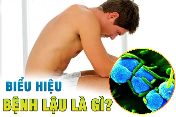 Biểu hiện bệnh lậu không khó nhận biết