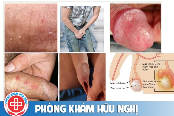 cac-benh-nam-khoa