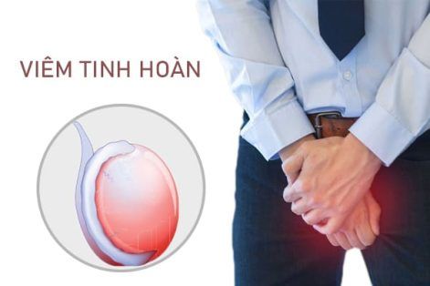 Các nguyên nhân gây viêm tinh hoàn ở nam giới là gì?