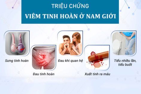Các triệu chứng viêm tinh hoàn bạn cần chú ý