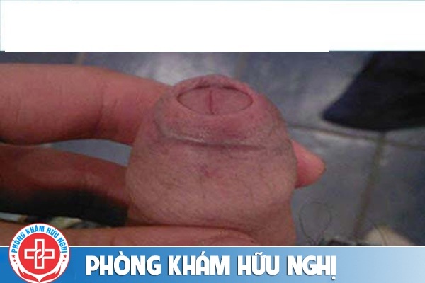 cach-lot-bao-quy-dau-tai-nha-1-(1)(2)