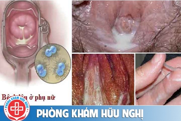chay-mu-am-dao