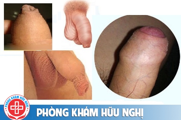 dai-hep-bao-quy-dau