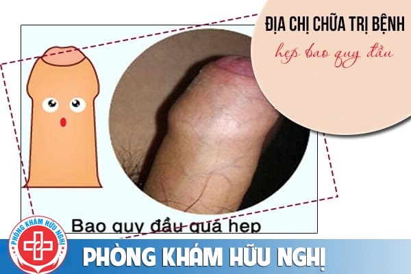DIA-CHI-CHUA-HEP-BAO-QUY-DAU