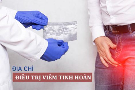 Địa chỉ hỗ trợ điều trị viêm tinh hoàn tốt tại TP Quy Nhơn