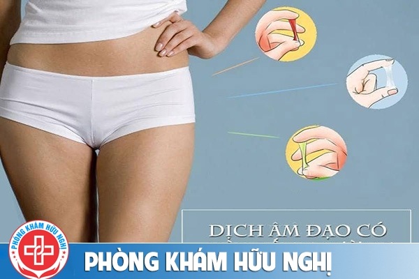 Chị em cần chú ý dấu hiệu dịch âm đạo có màu bất thường