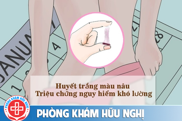 Huyết trắng màu nâu nguy hiểm như thế nào?