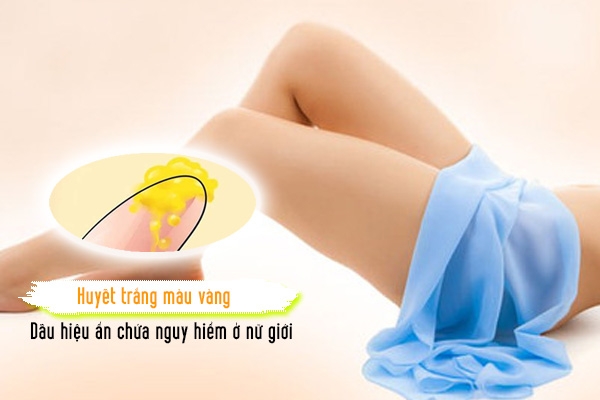 Dấu hiệu huyết trắng màu vàng có nguy hiểm không?