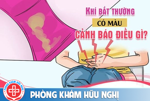 Biểu hiện khí hư có màu là bệnh gì ?