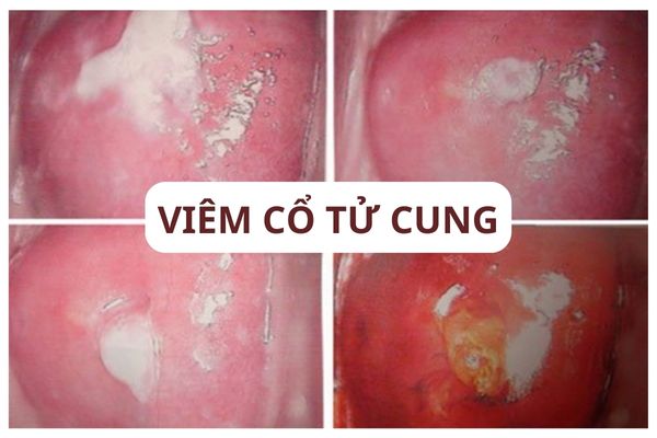khi-hu-mau-trang-co-nguy-hiem-khong-01