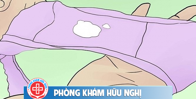 Nguy cơ viêm lộ tuyến cổ tử cung cao nếu âm đạo có khí hư vón cục màu trắng