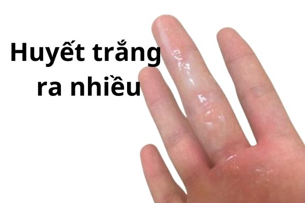 khi-huyet-trang-ra-nhieu-keo-dai-nguy-hiem-nhu-nao-02