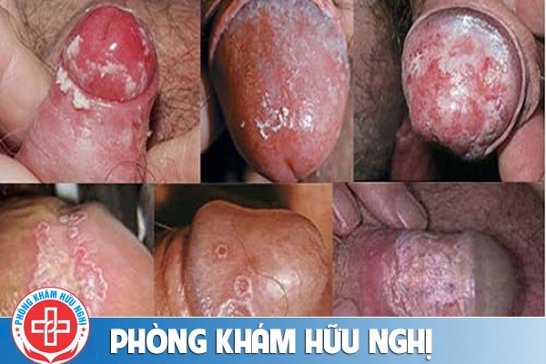 nam-bao-quy-dau-1
