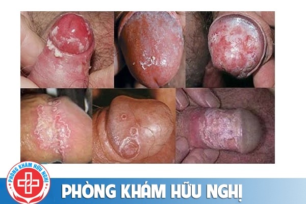 nam-duong-vat-nam