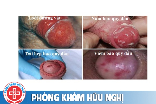 ngua-bao-quy-dau-nguyen-nhan