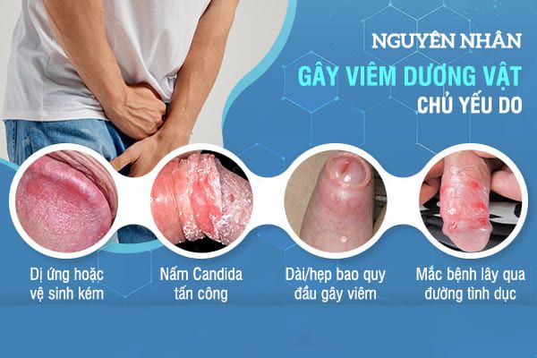 nguyen-nhan-viem-duong-vat