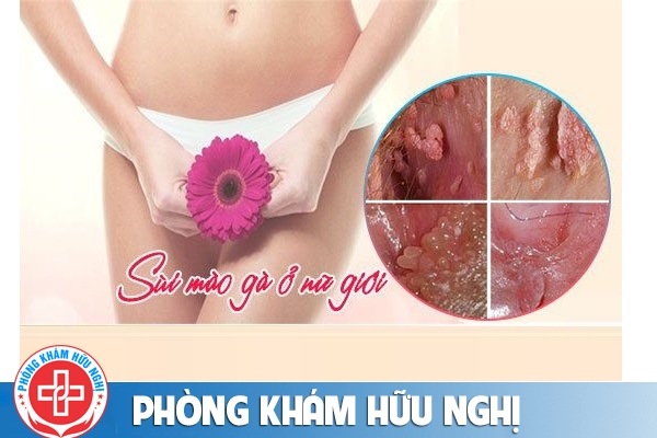 sui-mao-ga-am-dao