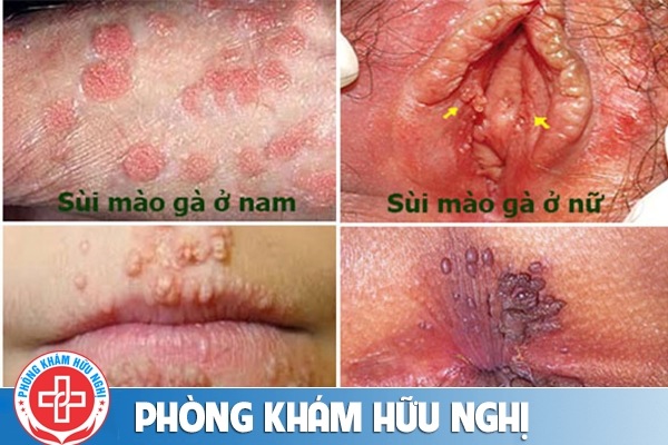 sui-mao-ga-nam-va-nu