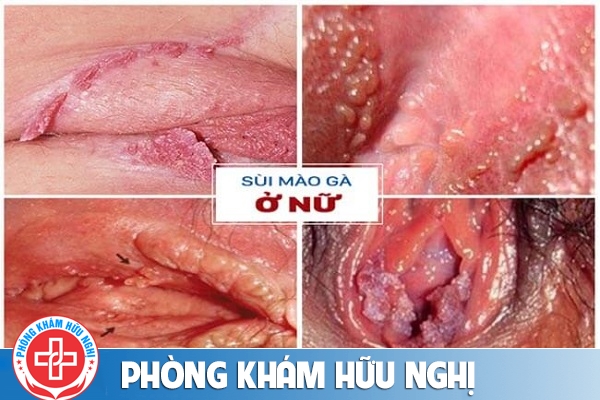 sui-mao-ga-nu