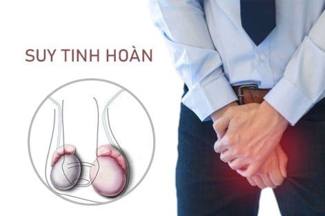 Suy tinh hoàn – nguyên nhân gây bất lực và vô sinh ở nam giới