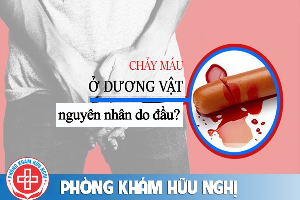 Tại sao nam giới lại bị dương vật chảy máu?