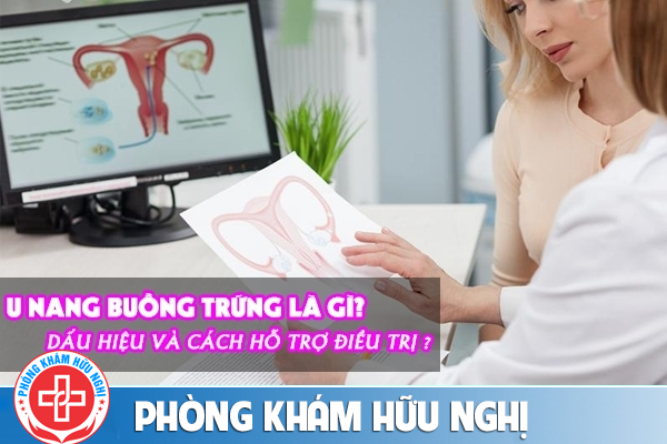 U nang buồng trứng – Dấu hiệu nhận biết và cách hỗ trợ điều trị