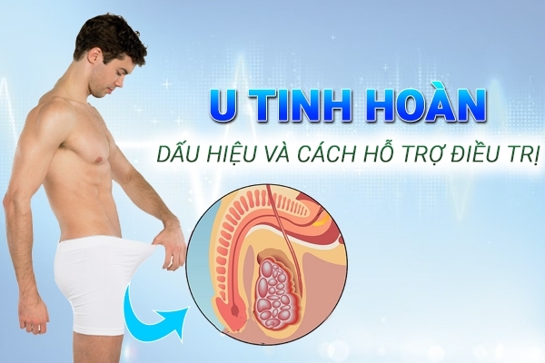 U tinh hoàn – Căn bệnh mà nam giới cần phải đề phòng
