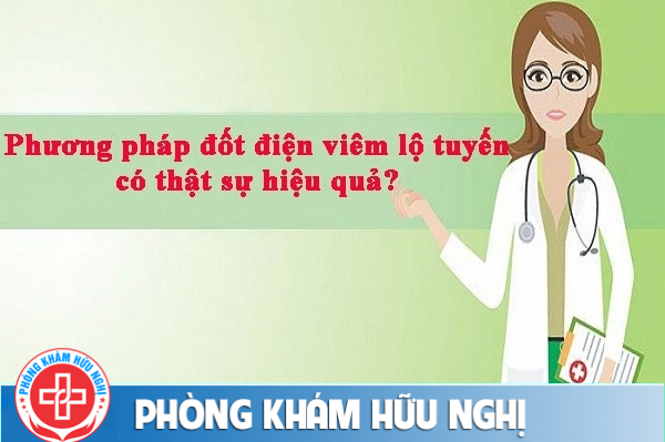 Liệu bị viêm lộ tuyến cổ tử cung đốt điện có hiệu quả không?