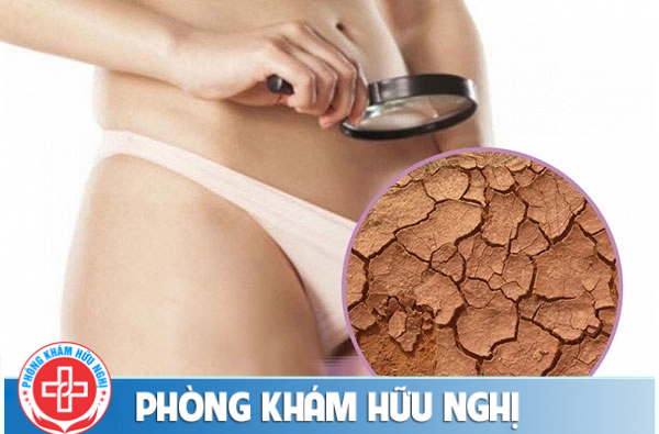 Triệu chứng khô âm đạo tiềm ẩn những nguy hiểm nào?