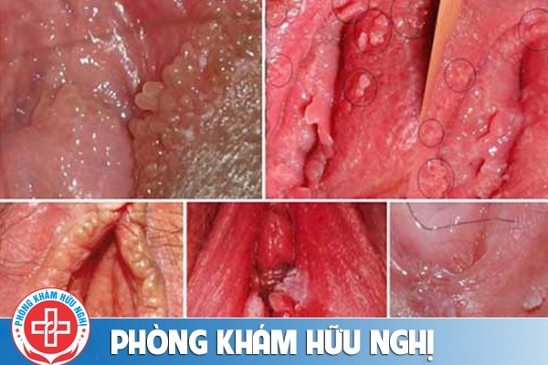 sui-mao-ga-co-ngua-khong