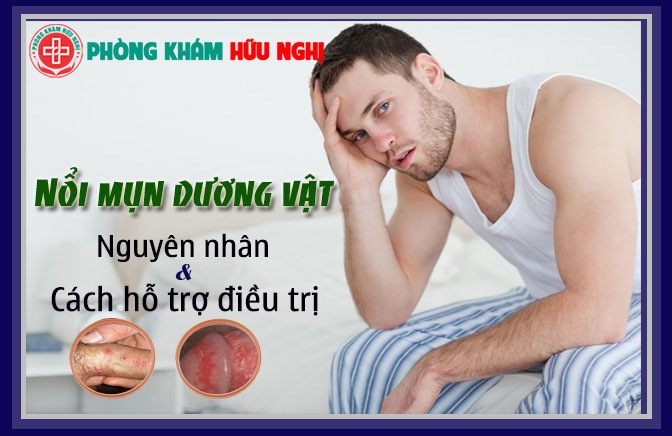 Nổi mụn ở dương vật nguyên nhân và cách hỗ trợ điều trị
