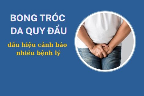 Tróc da quy đầu phải làm sao để chữa trị?
