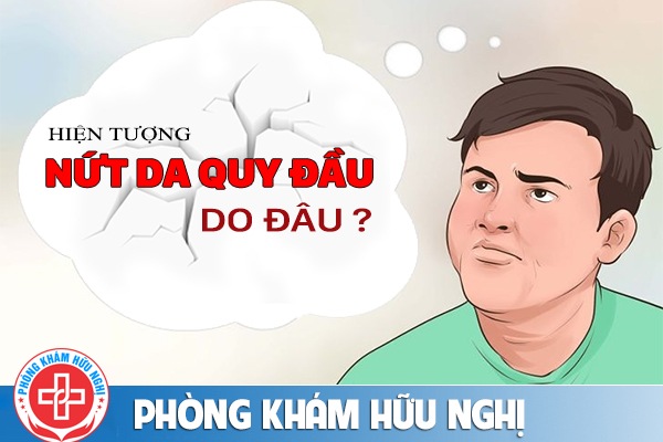 Nứt da quy đầu do đâu ? Dấu hiệu và phương pháp hỗ trợ điều trị