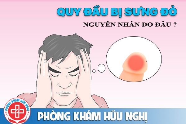 Nguyên nhân vì sao gây ra triệu chứng quy đầu bị sưng đỏ ?