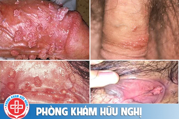 chua-sui-mao-ga-tai-da-nang