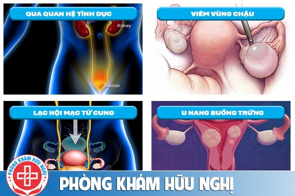điều trị đau bụng dưới