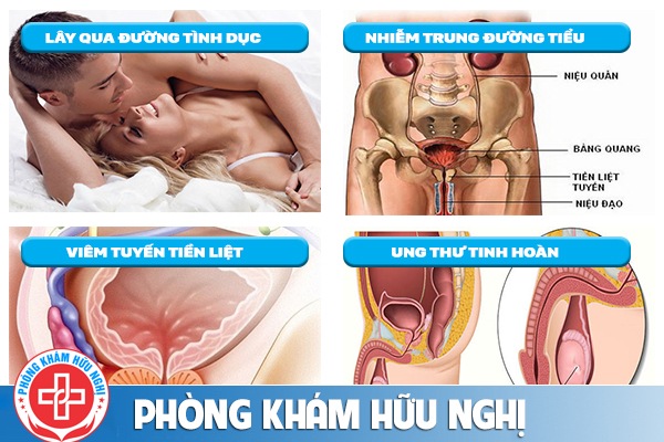 điều trị đau bụng dưới
