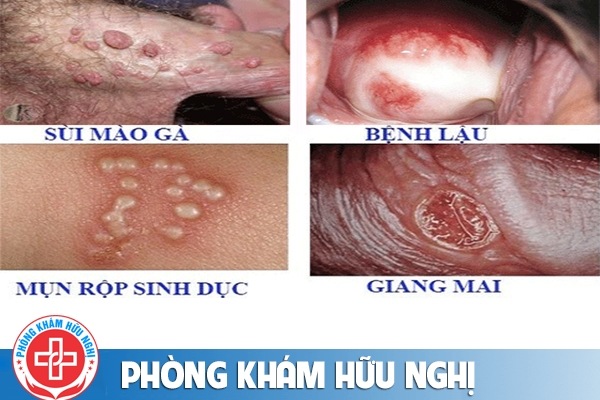benh-xa-hoi