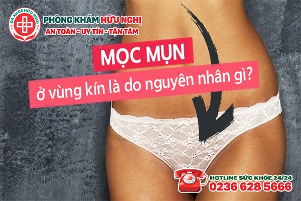 Nguyên nhân gây nổi mụn ở âm đạo là gì?