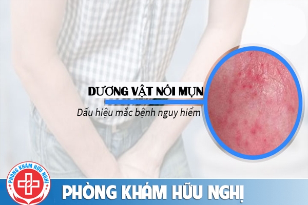 Nổi mụn vùng kín có nguy hiểm không?