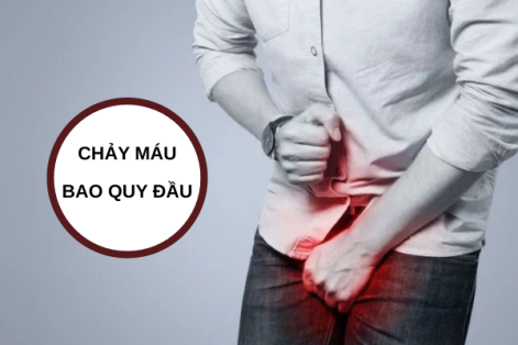 Chảy máu bao quy đầu là bị bệnh gì?