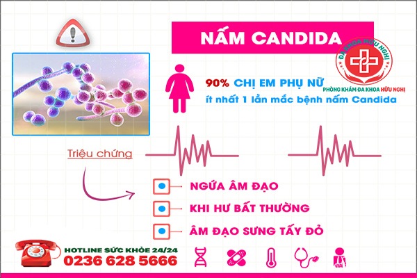 Triệu chứng của bệnh nấm Candida ở nữ là gì?