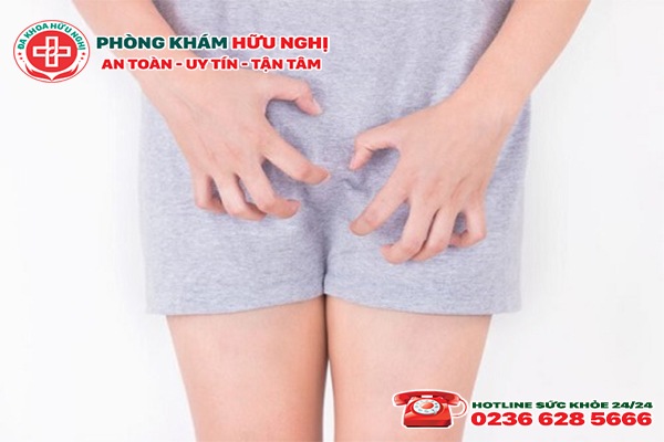 Hỗ trợ chữa ngứa âm đạo như thế nào?
