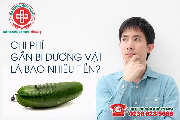 Chi phí gắn bi dương vật là bao nhiêu tiền?