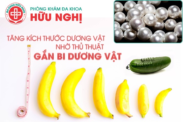chi phí gắn bi dương vật